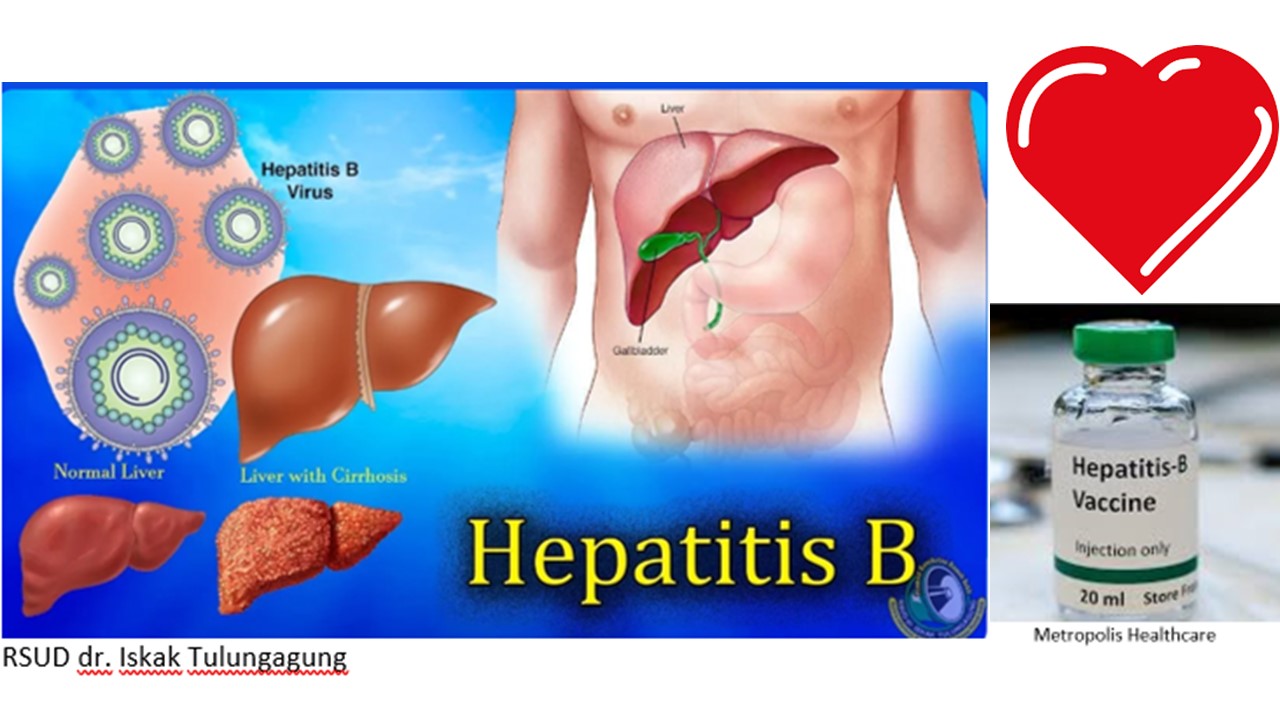Hari Hepatitis Sedunia: Hepatitis: Menggerogoti Hati, Merenggut Jiwa